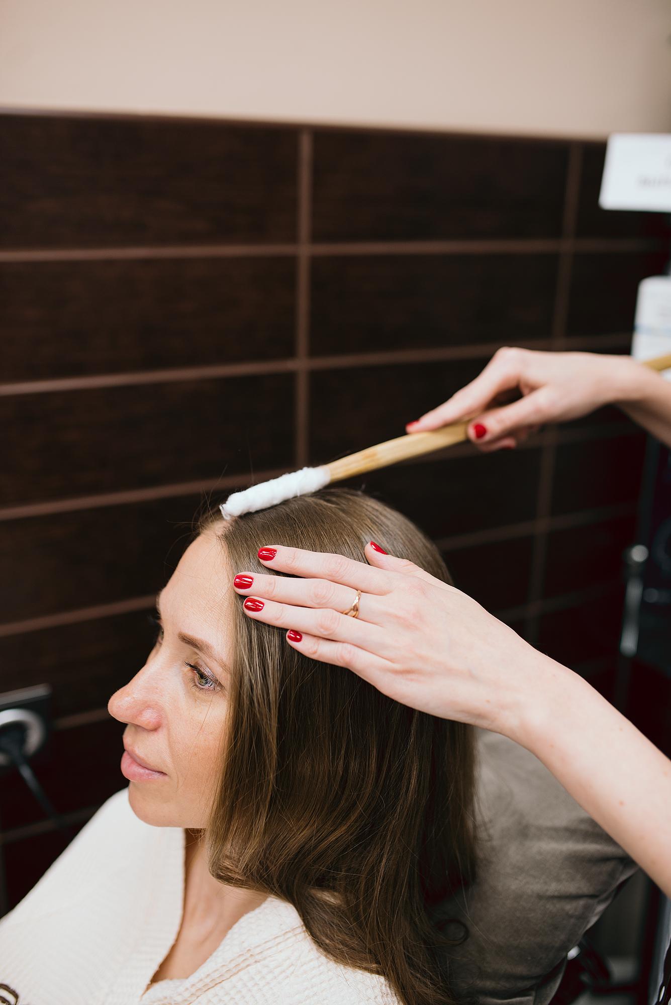 Криомассаж (азот)